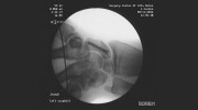 Lamont J Cardon MD