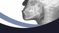 Jaw Surgery - Orthognathic Surgery