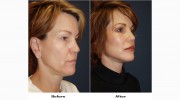 Abner Center For Plastic Surgery