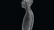 Partners Imaging Center-Sarasota
